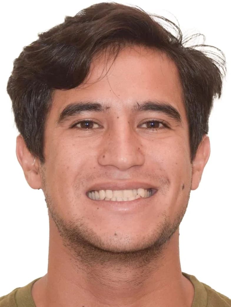 Before orthodontic treatment