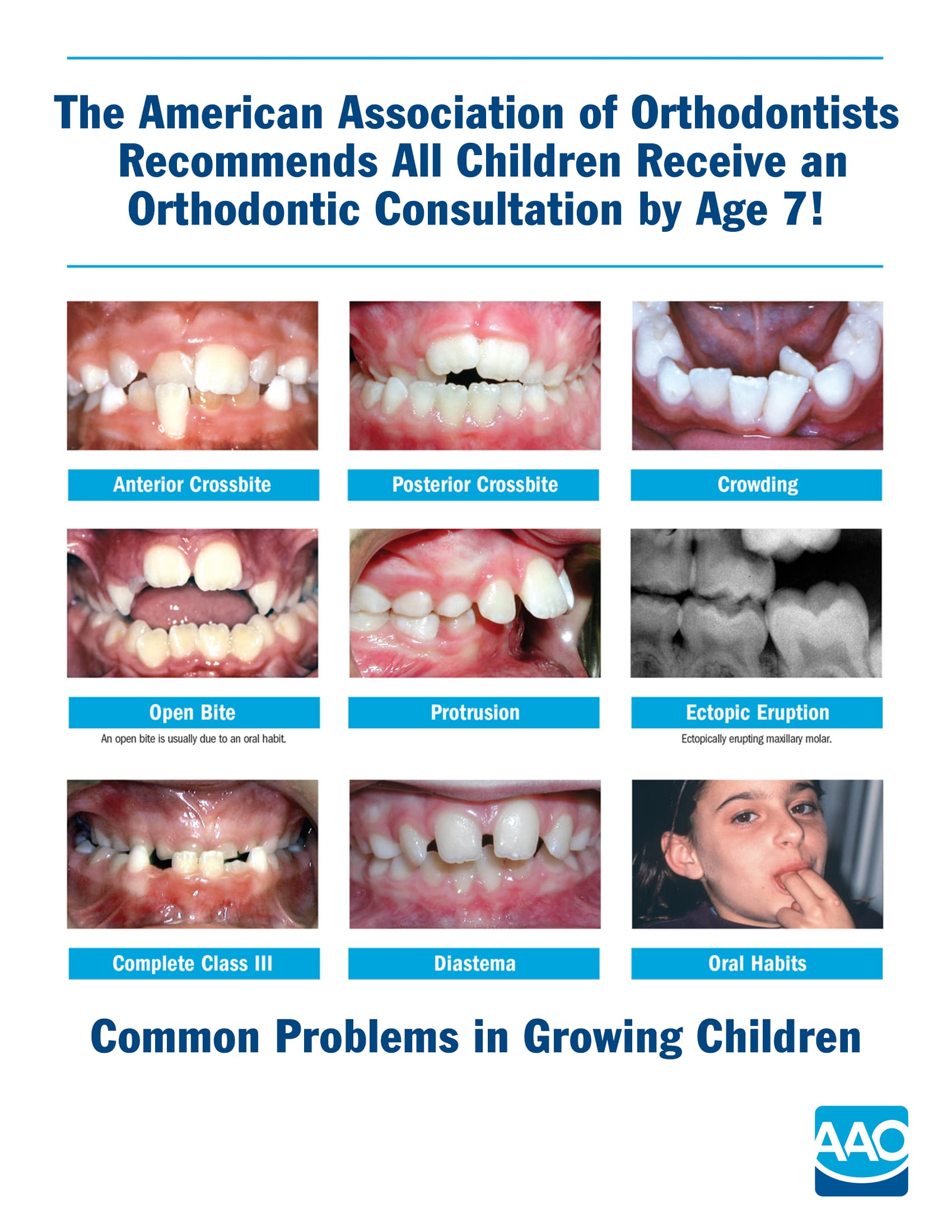 Orthodontic referral chart showing common problems in children